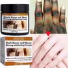 Donkere Knokkels Snel Oplichten Crème Ellebogen Hand Knokkel Oplichtend Serum Knie Zwarte Huid Snel Oplichten Vlekken Verwijderaar Producten