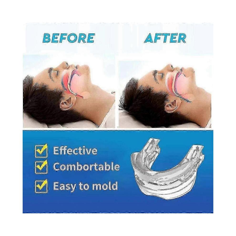 Adjustable Anti Snoring Mouthpiece Guard Anti Snore Sleep Apnea Teeth Grind