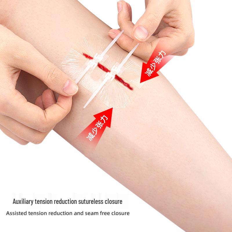 Self-Adhesive Transparent PU Elastic Bandage for Suture-Free Wound Closure