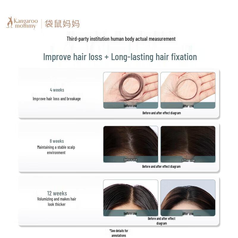 Kangaroo Mommy Anti-Hair Loss Shampoo