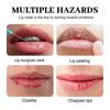Limited time!!Hoygi Moisturizing Lip Mask Patch Winter Hydration, Nourishing, Anti-Chapping, Reduces Lip Lines, Easily Absorbed Lip Mask Patch