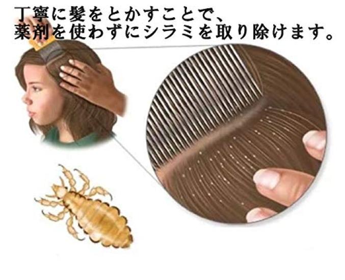 Beatus Luskam för att säkert ta bort löss och loppor utan kemikalier Anpassningsbar - - Set! (1 Röd)