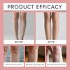 Edema Gel Relief Edema Gel Improves Tightness And Is Suitable For Discomfort From Prolonged Sitting Red Vine Fluid Relief Edema Gel