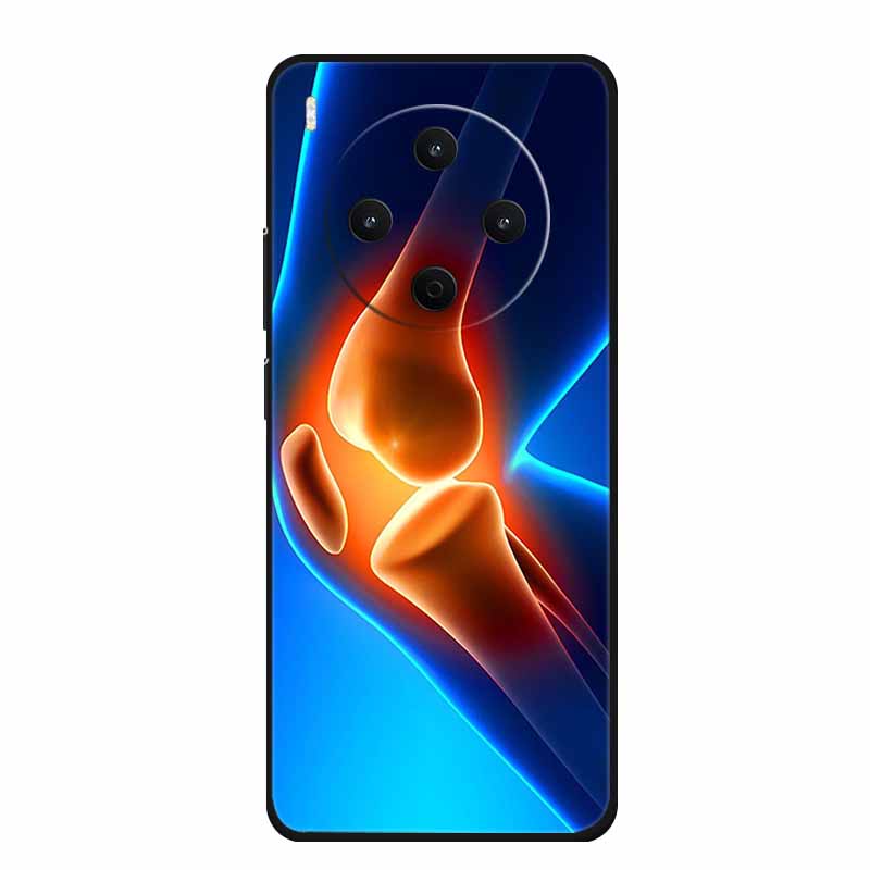 Black Silicone Case For Vivo Y500 Pro 5G 2025 Case Cartoon Cat Soft Back Cover For Vivo Y500 Pro Phone Case 6.67" Fundas Coque