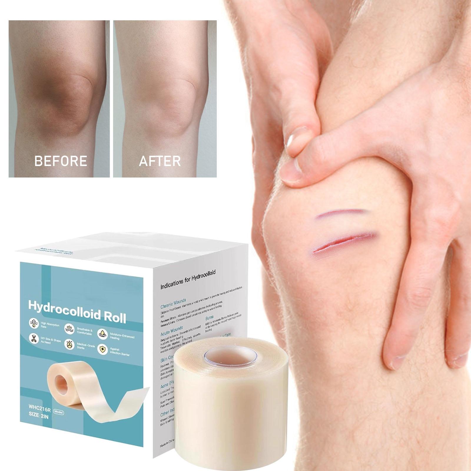 

Hydrocolloid Roll For Care Cut To Size, Extra Large Hydrocolloid Patch Bandages With Self-Adhesive, Ultra Absorbent, Flexible Waterproof, Aid Kit One Size