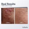 Celladix Sebum Rebalancing RX 131 Ampoule 20ml