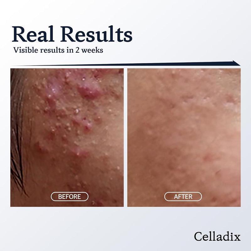 Celladix Sebum Rebalancing RX 131 Ampoule 20ml