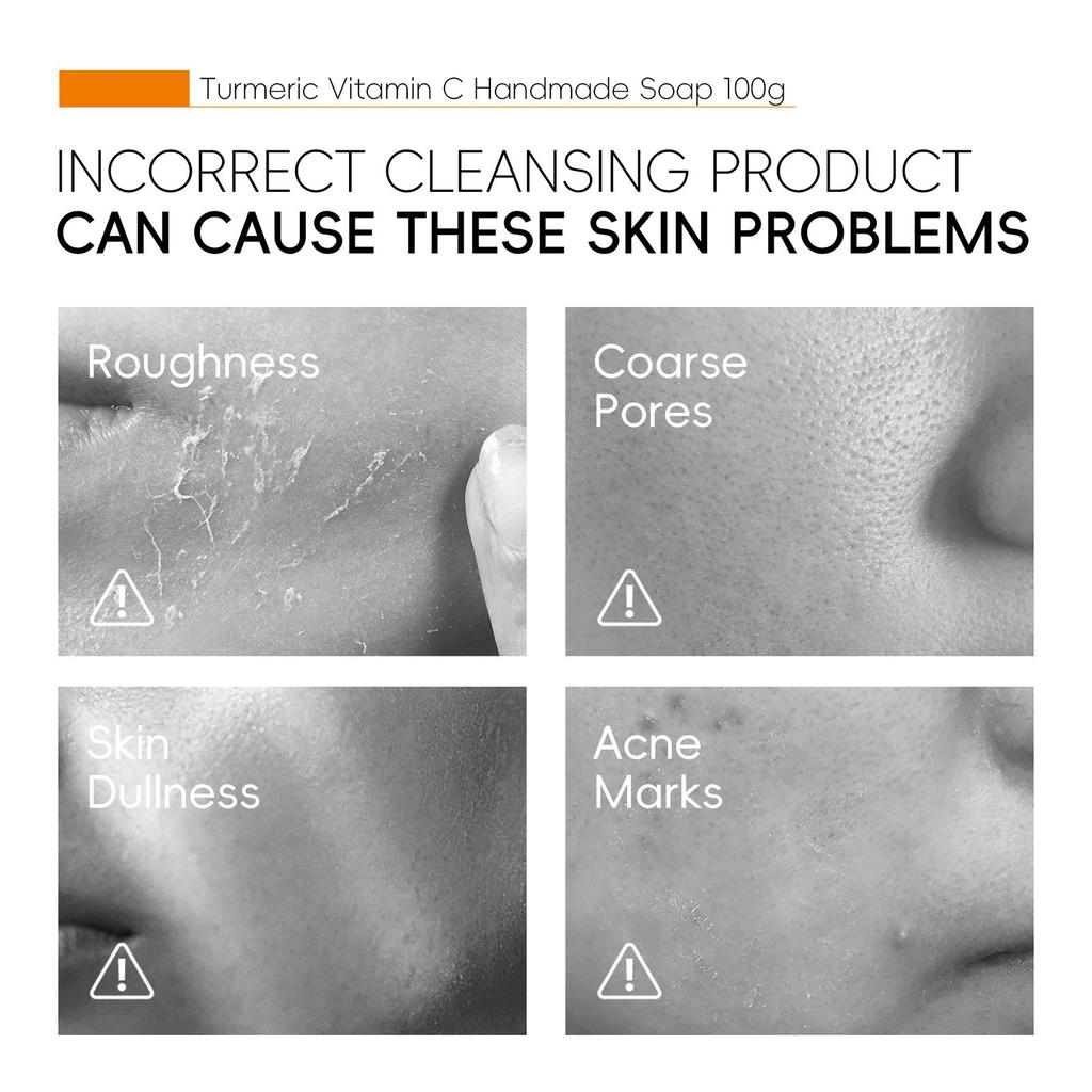 Curcuma VC Serum Oil Facial Soap 100g For Cleansing And Moisturizing Face And Body