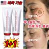 Spot Freckle Removal Cream, Melatoning Cream, Blemish Removal, Age Spot Removal, Whitening Cream, Pigmentation/guaranteed Effect!!, 2 Pieces