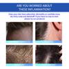 South Moon Seborrheic Dermatitis Cream Effective Relief For Scalp And Skin Problems