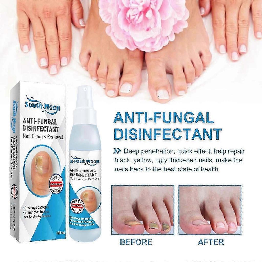 Nail Repair Spray Repair And Clean Nails, Hands, Feet, Soft Nails, Thicken Nails, Polish Nails100ml