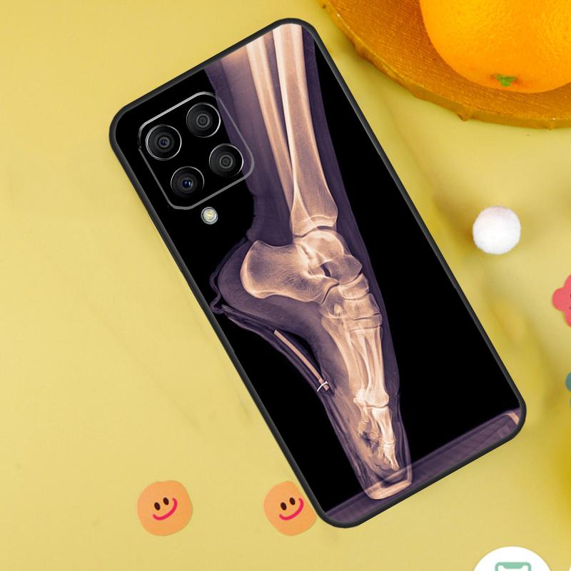 X-Ray Human Anatomy For Samsung Galaxy M54 M34 M14 M12 M32 M52 M53 M33 M13 M20 M21 M51 M15 M55 M31s M30s Case