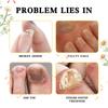 Nail Repair Essence Liquido Mani e Piedi Unghie Grigie Unghie Morbide Ingiallimento Unghie Spesse Lucide Pulizia Unghie Riparazione