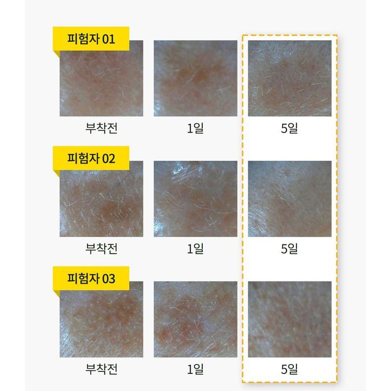 CURESYS Dark Spot AC Patch