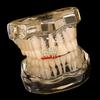 New Single and Double Flame Pattern Full Zircon Gold Teeth Halloween Hot Cosplay Versatile Dental Jewelry Braces Wholesale