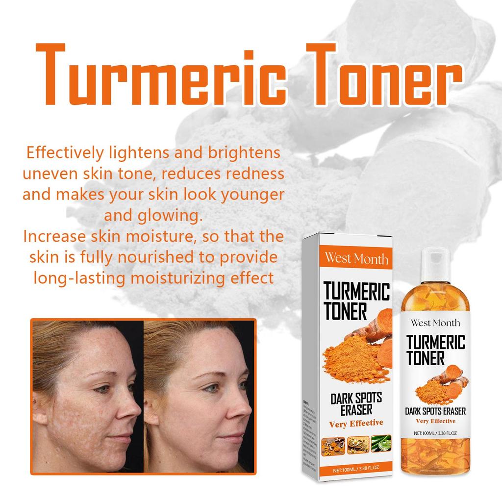 West&Month Anti-Dark Turmeric Toner ,Deeply Hydrates and Moisturizes, Brightens and Firms Facial Skin, Suitable for Face 100ml