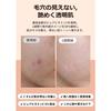 Klairs Freshly Juiced Vitamin Drop 35ml - Serum Vitamin C Raw Vitamin C Serum Pores Dead Skin Dry Skin Moisture Skin Care Hypoallergenic Ampoule