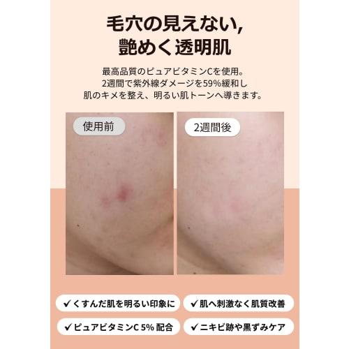 Klairs Freshly Juiced Vitamin Drop 35ml - Serum Vitamin C Raw Vitamin C Serum Pores Dead Skin Dry Skin Moisture Skin Care Hypoallergenic Ampoule