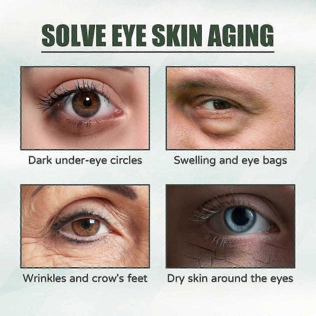 Anti-Aging Eye Cream for Dark Circles & Puffiness Reduces Fine Lines, Wrinkles, and Crows Feet Deeply Moisturizes, Firms, and Brightens Delicate Ski N