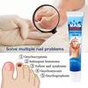 Nail Treatment Cream Antibacterial Repair Ointment Whitening Toe Anti Infection Nail Repair Cream Nail Care