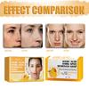 100g Skin Exfoliation Soap Moisturizing Delicate Texture Hydrating Whitening Oil Control Brighten Universal Kojic Acid Dark Remover Soap