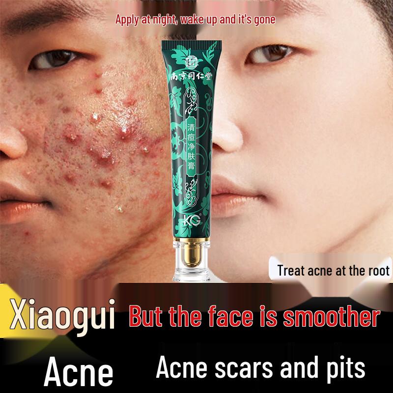 Tong Ren Tang Acne & Blemish Repair Cream