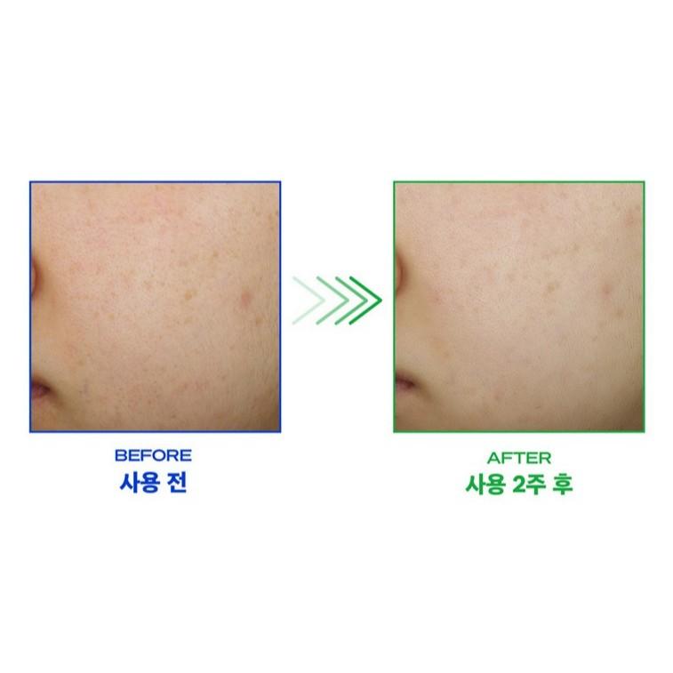 B. READY Cicaffeine Ser Resetare Imperfecțiuni 40mL