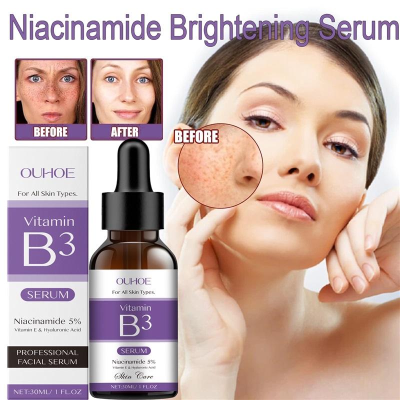 Korea Niacinamid Gesichtsserum Vitamin B3 Falten Pigment Dunkle Flecken Reduzieren Korrigierendes Glow Serum Gesichtsaufhellung Feuchtigkeitscreme