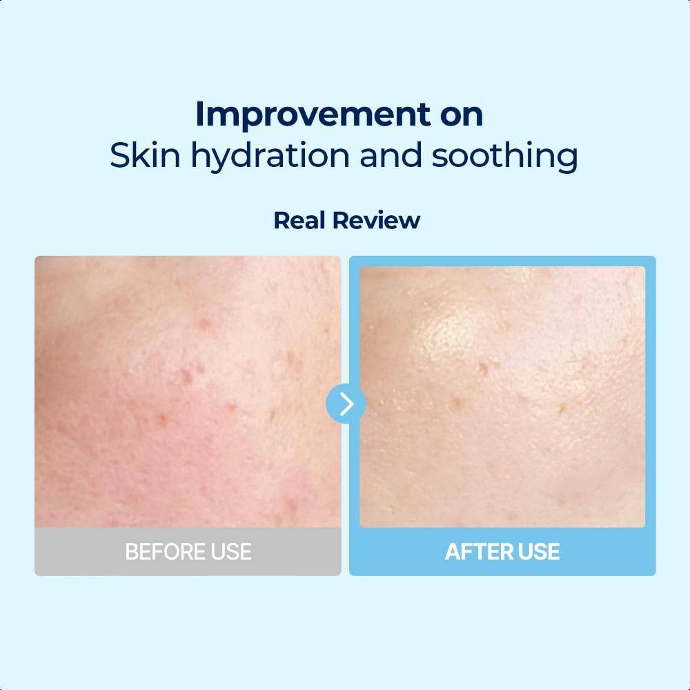Torriden DIVE-IN Low Molecular Hyaluronic Acid Multi Pad 80ea/160ml
