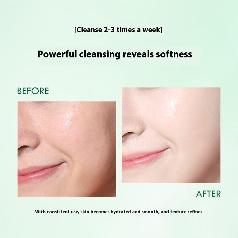 Ice Crystal Cleansing Gel Cleansing Cream for Face Blackening Discharge Black Toxins Blackhead Acne Shrinking Pores for Beauty