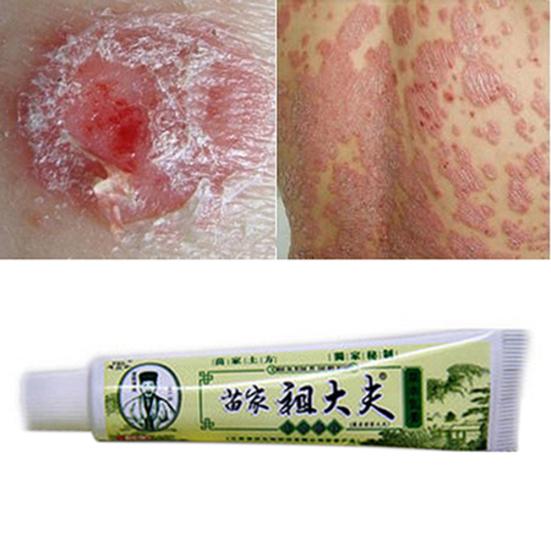 20Pcs Herbal Antibacterial Skin Cream Dermatitis Itching Repairing Ointment