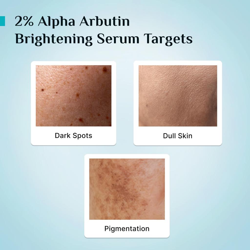 Pilgrim 2% Alpha Arbutin 3% Vitamin C Brightening Face Serum For Radiant Glow All Skin Types Pack Of 2 30 ml