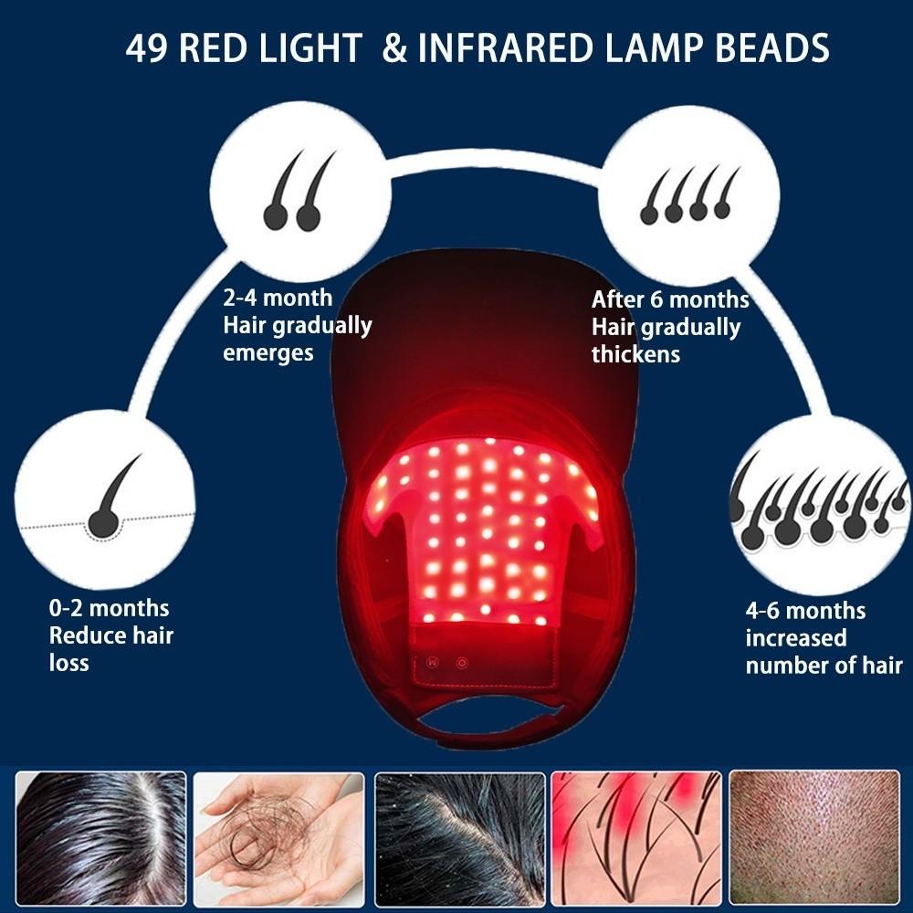 LED Red Light Therapy Cap Hair Growth Hat Red & Infrared Light Therapy Device for Hair Loss Treatment Hair Regrowth
