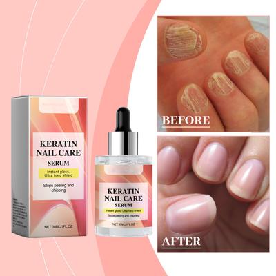 Nail Care Essenceoils 30ml Hand And Foot Nails Strong Finger Edge Nail Surface Moisturizing Care Essenceoils