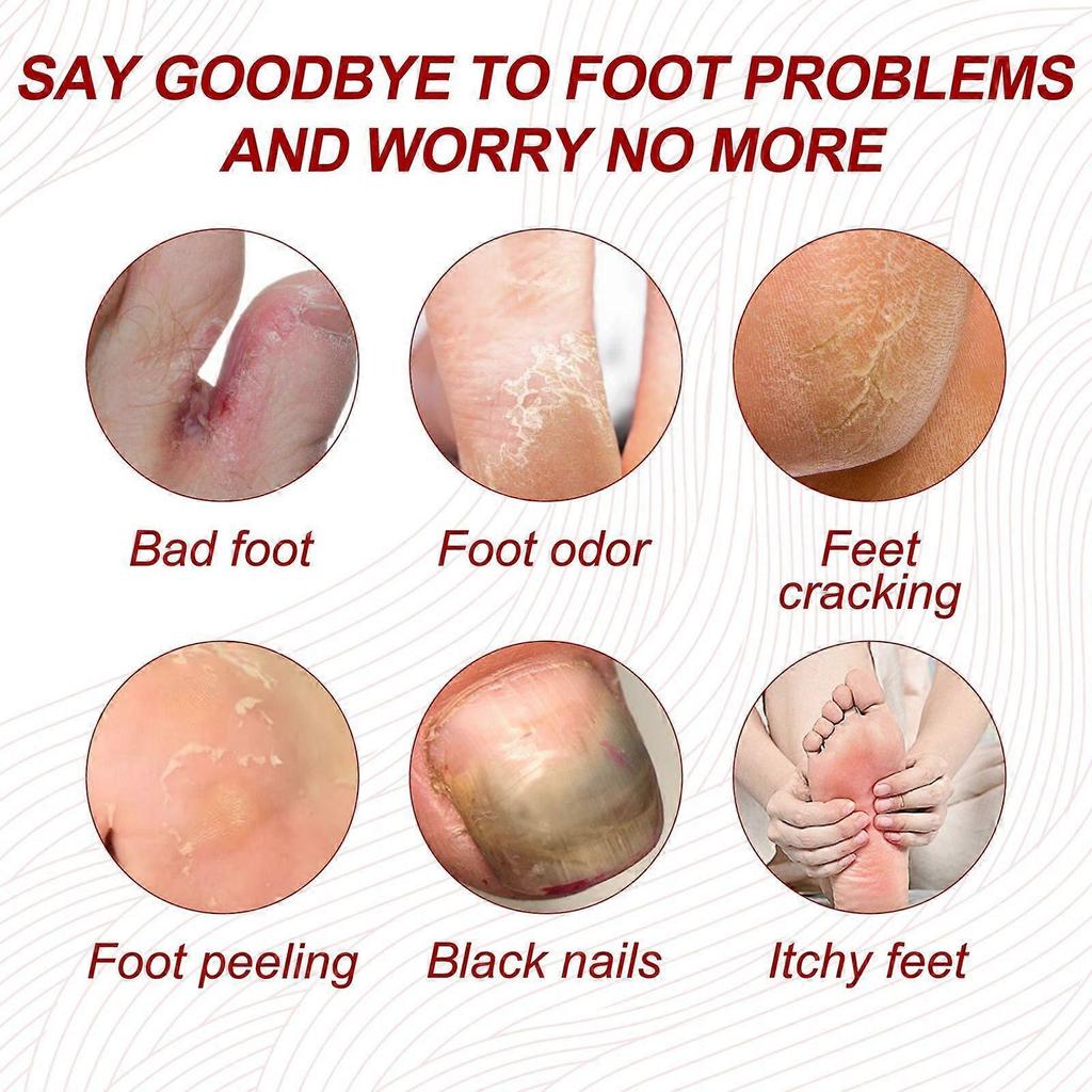 Ximonth Nail Repair Cream For Gray Nails  Repairs And Brightens Nails, Treats Ingrown And Rotting Toenails, Thickened Nails, And Nail Groove Care