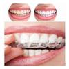 A Set of 4 Thermoforming Teeth Whitening and Gel Bleaching Trays
