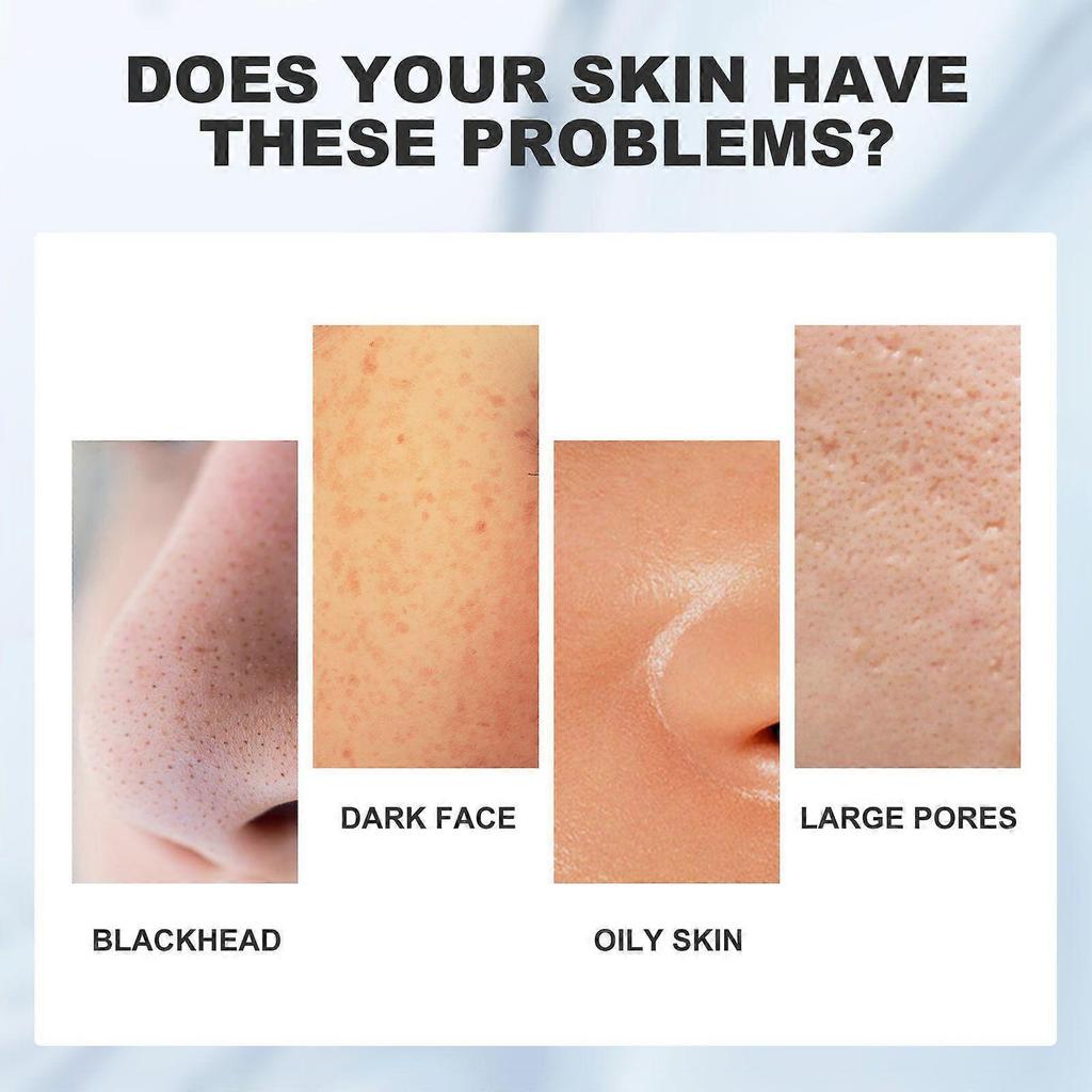 Limited time!!Eelhoe Dead Sea Mud Cleansing Mask Hydrating Deep Cleansing For Skin, Blackhead And Acne Control, Deep Oil Control Mud Mask