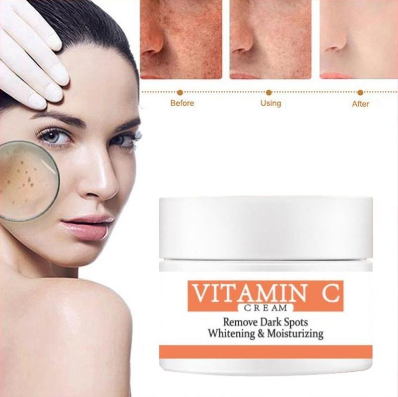 Cea mai nouă cremă de albire pentru față cu vitamina C, care repara pistruii decolorați, îndepărtează petele întunecate Cremă de față pentru înlăturarea melaninei