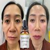 Retinol Face Serum Repair Skin Anti-Aging Anti-wrinkle Deep SkinCare Essence Acne Scar Removal Skin Whitening Cream