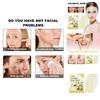 Ouhoe Yellow Acne Patches For Gentle Skin Repair And Effective Pimple Treatment With Oil Control And Hydration 140 Pieces