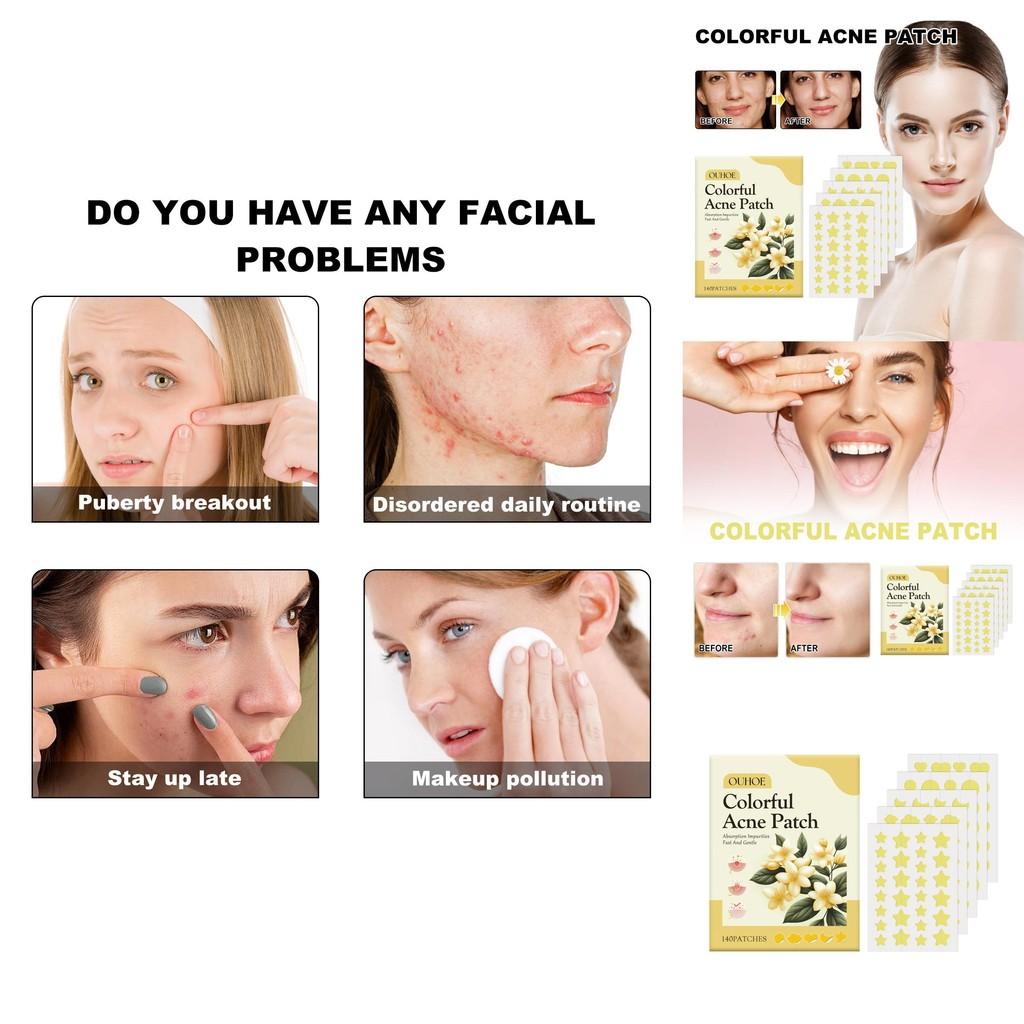 Ouhoe Yellow Acne Patches For Gentle Skin Repair And Effective Pimple Treatment With Oil Control And Hydration 140 Pieces