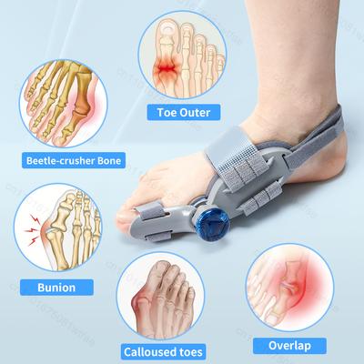Durable And Safe Bunion Corrector Rotatable Hallux Valgus Braces Toe Separator Straightener Pain Relief Toe Valgus Corrector Orthopedic Pedicure