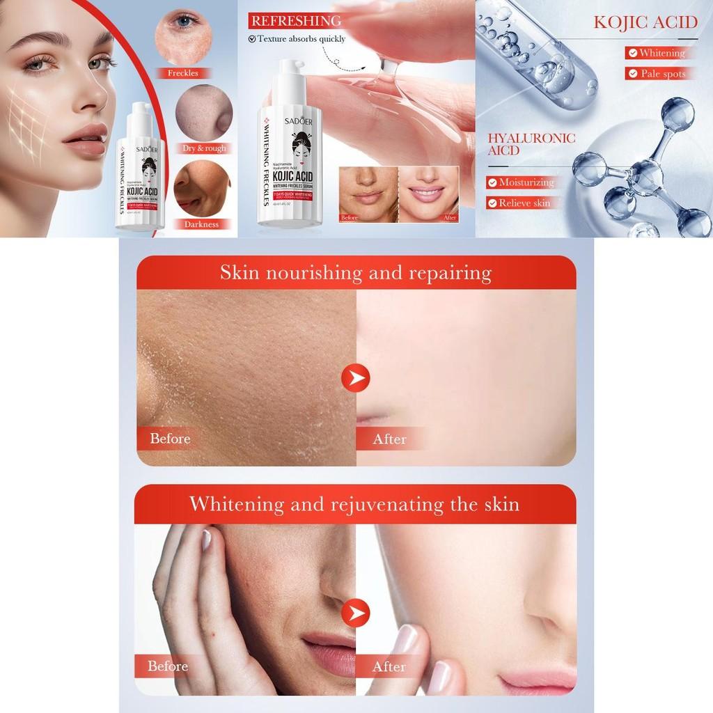 Sadoer Quinic Acid Brightening Serum 40ml Hydrating And Skin-softening Essence For Even Tone