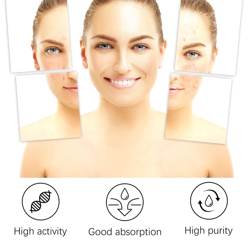 Acne Cream, Facial Cleansing And Acne Cleansing Cream, Gentle Acne Removing And Brightening Facial Skin Care Cream