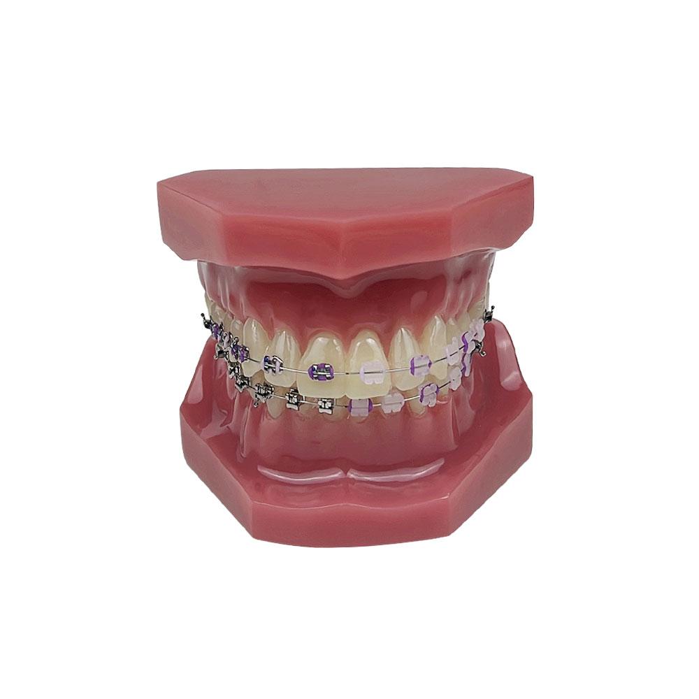 New Orthodontic Teeth Model With Braces Bracket Metal/Ceramic Self-Locking Orthodontic Dental Model Dentistry Treatment For Demo