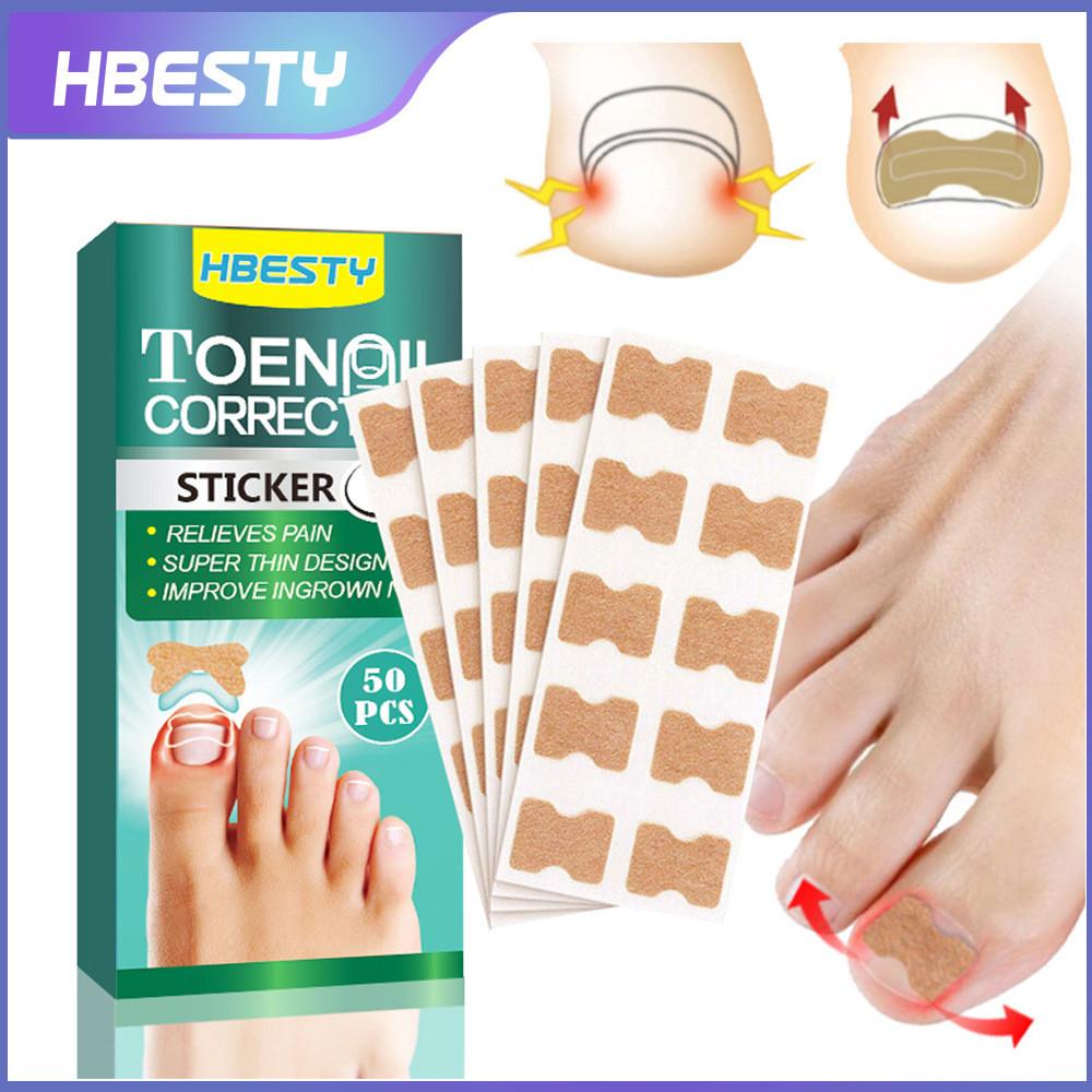 

Nail Toe Besty Correction Stickers For Ingrown Toenails Herbal Scented Care Foot