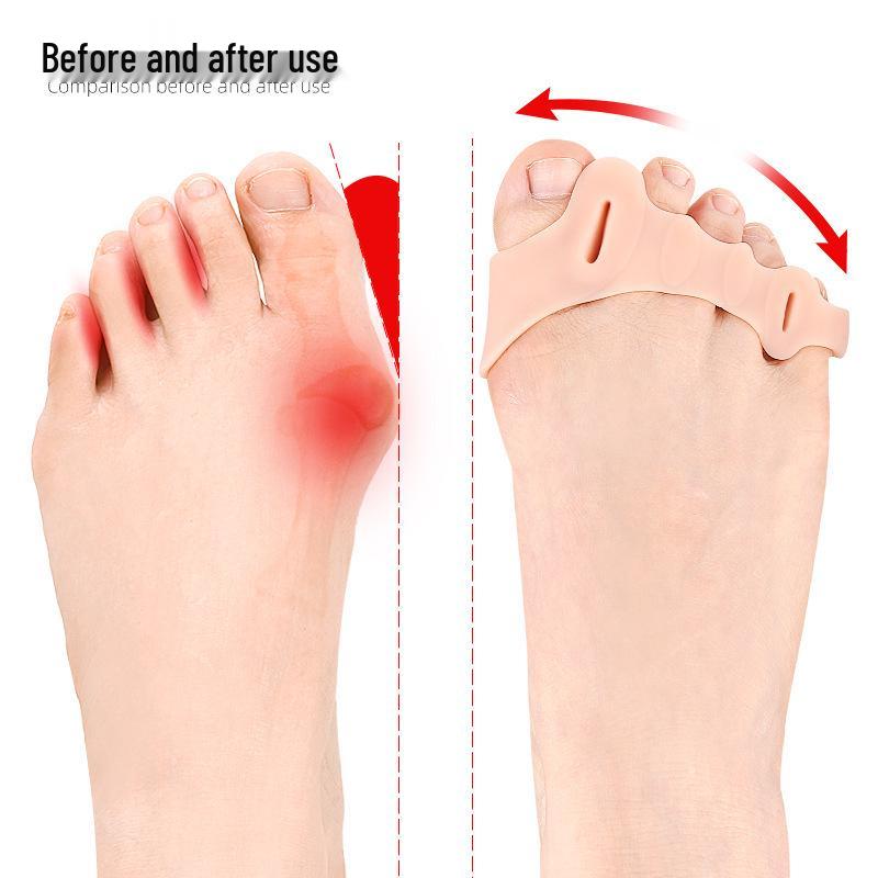 Five-Toe Arch Support Separator with Soft Shock Absorption and Pressure Relief, Massage Forefoot Insole, Hallux Valgus Corrector