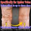 Varicose Veins Relief Cream - Natural Herbal Blend Gentle On Delicate Skin