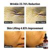 DERMA FACTORY Fiala PDRN 4% 30ml ( 3 Opzioni)