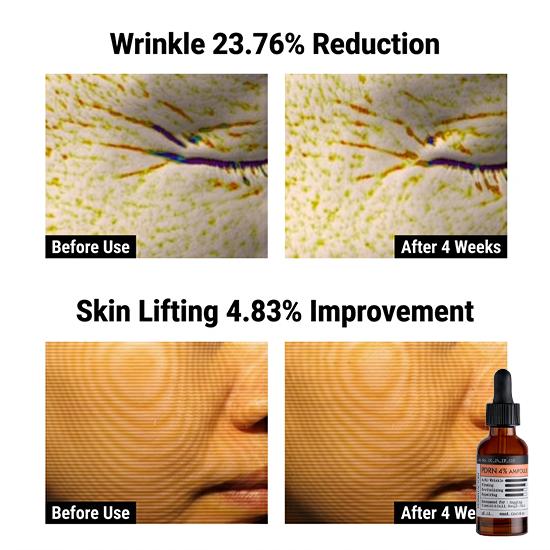 DERMA FACTORY Fiala PDRN 4% 30ml ( 3 Opzioni)